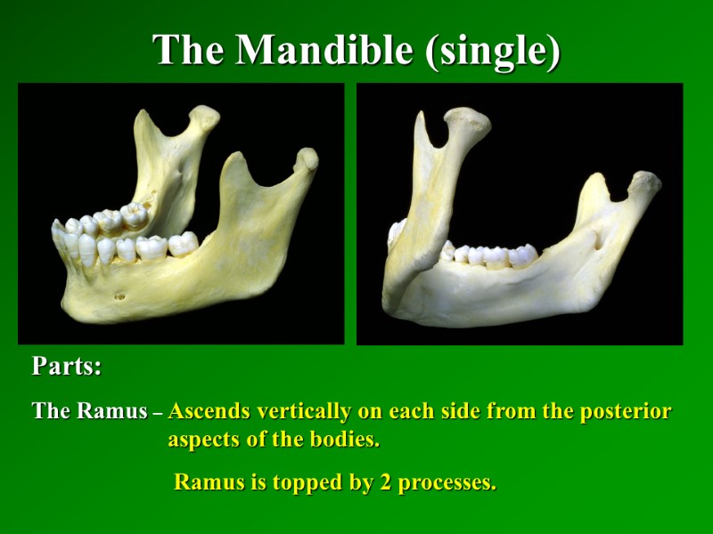 The Mandible (single)   Parts: The Ramus – Ascends vertically on each side